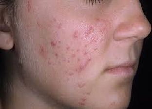 skin