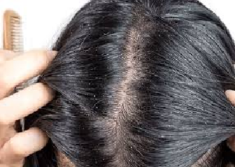 Hair